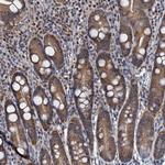 p23 Antibody in Immunohistochemistry (Paraffin) (IHC (P))