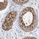 p23 Antibody in Immunohistochemistry (Paraffin) (IHC (P))