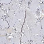 p23 Antibody in Immunohistochemistry (Paraffin) (IHC (P))