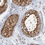 p23 Antibody in Immunohistochemistry (Paraffin) (IHC (P))