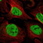 UNC93B1 Antibody in Immunocytochemistry (ICC/IF)