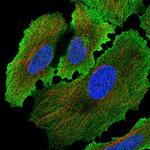 Placental Alkaline Phosphatase Antibody in Immunocytochemistry (ICC/IF)