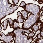 Placental Alkaline Phosphatase Antibody in Immunohistochemistry (Paraffin) (IHC (P))