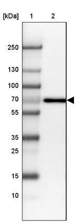 Placental Alkaline Phosphatase Antibody in Western Blot (WB)