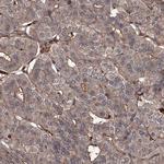 GRIP1 Polyclonal Antibody