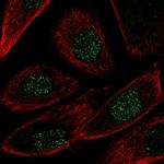 NRG2 Polyclonal Antibody