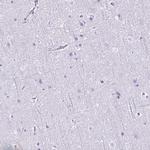 CD27 Antibody in Immunohistochemistry (Paraffin) (IHC (P))