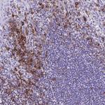 CD27 Antibody in Immunohistochemistry (Paraffin) (IHC (P))
