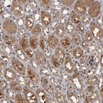SNX15 Antibody in Immunohistochemistry (Paraffin) (IHC (P))