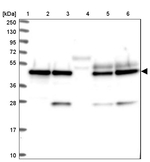 SNX15 Antibody in Western Blot (WB)