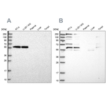 SAAL1 Antibody in Western Blot (WB)