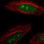 DDX23 Polyclonal Antibody
