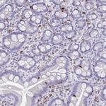 CD7 Antibody in Immunohistochemistry (Paraffin) (IHC (P))