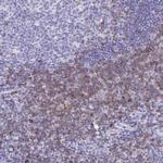 CD7 Antibody in Immunohistochemistry (Paraffin) (IHC (P))