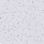 CD7 Polyclonal Antibody