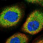 MARK4 Polyclonal Antibody