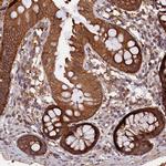 MARK4 Antibody in Immunohistochemistry (Paraffin) (IHC (P))