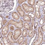 LATS2 Antibody in Immunohistochemistry (Paraffin) (IHC (P))