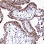 LATS2 Antibody in Immunohistochemistry (Paraffin) (IHC (P))