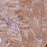 LATS2 Antibody in Immunohistochemistry (Paraffin) (IHC (P))