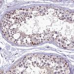 LATS2 Polyclonal Antibody