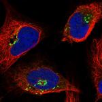 OSBP Polyclonal Antibody