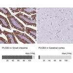 PLCB3 Antibody