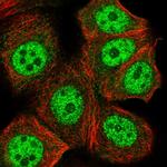 PLCB3 Polyclonal Antibody