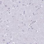 PLCB3 Antibody in Immunohistochemistry (Paraffin) (IHC (P))