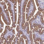 PLCB3 Antibody in Immunohistochemistry (Paraffin) (IHC (P))
