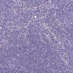 PLCB3 Antibody in Immunohistochemistry (Paraffin) (IHC (P))