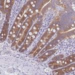PLCB3 Antibody in Immunohistochemistry (Paraffin) (IHC (P))