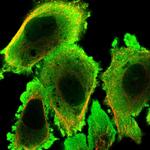 STIP1 Polyclonal Antibody