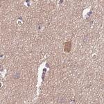 STIP1 Antibody in Immunohistochemistry (Paraffin) (IHC (P))
