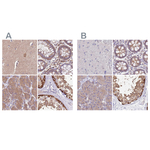 STIP1 Antibody in Immunohistochemistry (Paraffin) (IHC (P))