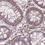 STIP1 Antibody in Immunohistochemistry (Paraffin) (IHC (P))