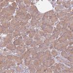 STIP1 Antibody in Immunohistochemistry (Paraffin) (IHC (P))