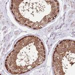 STIP1 Antibody in Immunohistochemistry (Paraffin) (IHC (P))