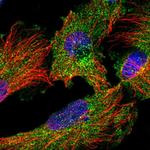 DNM1L Polyclonal Antibody