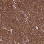 DNM1L Antibody in Immunohistochemistry (Paraffin) (IHC (P))