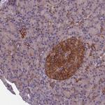 DNM1L Antibody in Immunohistochemistry (Paraffin) (IHC (P))
