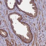 DNM1L Antibody in Immunohistochemistry (Paraffin) (IHC (P))
