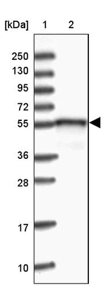 DNAJC3 Antibody in Western Blot (WB)