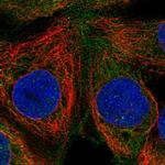 RASGRP1 Antibody in Immunocytochemistry (ICC/IF)