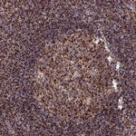 HICE1 Polyclonal Antibody