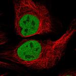 p70 S6 Kinase Polyclonal Antibody