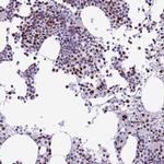 p70 S6 Kinase Antibody in Immunohistochemistry (Paraffin) (IHC (P))