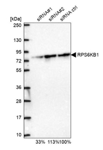 p70 S6 Kinase Antibody in Western Blot (WB)