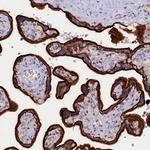 PACSIN3 Polyclonal Antibody