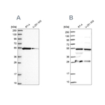 PACSIN3 Antibody in Western Blot (WB)